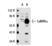 CaMKKα (R-73): sc-11370. Western blot analysis of CaMKKα expression in non-transfected: sc-117752 (A) and human CaMKKα transfected: sc-114479 (B) 293T whole cell lysates.