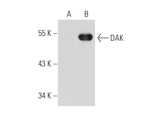 DAK (A-19): sc-161514. Western blot analysis of DAK expression in non-transfected: sc-110760 (A) and human DAK transfected: sc-110850 (B) 293 whole cell lysates.