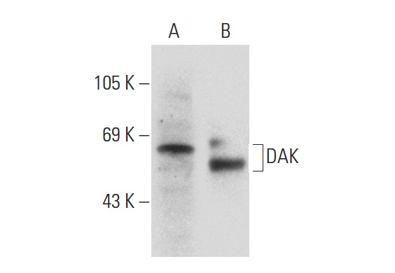 DAK (A-19): sc-161514. Western blot analysis of DAK expression in Hep G2 whole cell lysate (A) and mouse kidney tissue extract (B).