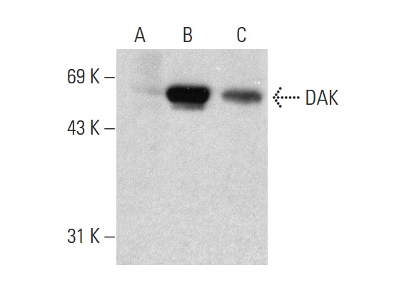 DAK (A-19): sc-161514. Western blot analysis of DAK expression in non-transfected: sc-117752 (A) and mouse DAK transfected: sc-119655 (B) 293T whole cell lysates and mouse liver tissue extract (C).