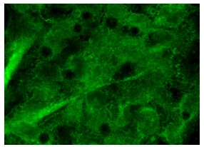 DAK (A-19): sc-161514. Immunofluorescence staining of formalin-fixed Hep G2 cells showing cytoplasmic localization.
