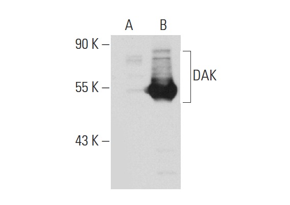 DAK (C-17): sc-161515. Western blot analysis of DAK expression in non-transfected: sc-110760 (A) and human DAK transfected: sc-110850 (B) 293 whole cell lysates.