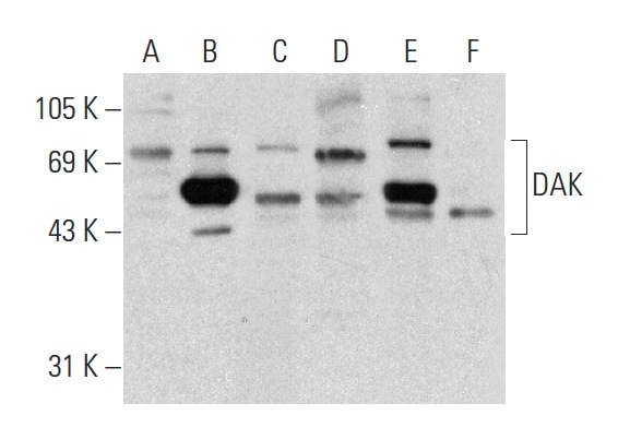 DAK (C-17): sc-161515. Western blot analysis of DAK expression in non-transfected 293T: sc-117752 (A), mouse DAK transfected 293T: sc-119655 (B), Hep G2 (C) and HeLa (D) whole cell lysates and mouse liver (E) and mouse kidney (F) tissue extracts.