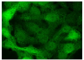 DAK (C-17): sc-161515. Immunofluorescence staining of formalin-fixed Hep G2 cells showing cytoplasmic and nuclear localization.