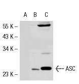 ASC (H-120): sc-30153. Western blot analysis of ASC expression in non-transfected 293T: sc-117752 (A), mouse ASC transfected 293T: sc-126449 (B) and HL-60 (C) whole cell lysates.