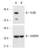 ICAD siRNA (h): sc-35624. Western blot analysis of ICAD expression in non-transfected control (A) and ICAD siRNA transfected (B) HeLa cells. Blot probed with ICAD (FL-331): sc-9066. GAPDH (FL-335): sc-25778 used as specificity and loading control.