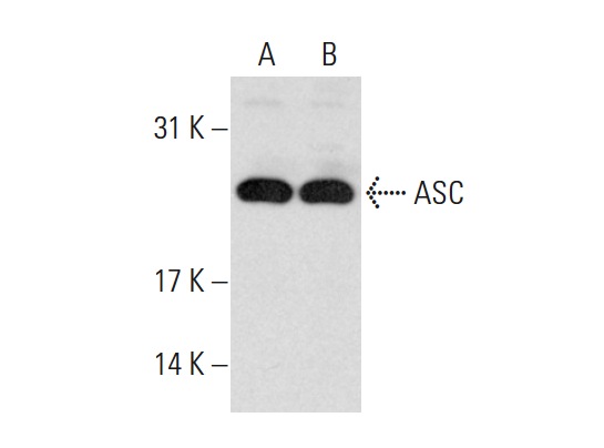 ASC (H-120): sc-30153. Western blot analysis of ASC expression in HL-60 (A) and SK-MEL-28 (B) whole cell lysates.