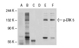 Western blot analysis of ERK 5 phosphorylation in untreated (A,D), EGF treated (B,E) and EGF and lambda protein phosphatase treated (C,F) HeLa whole cell lysates. Antibodies tested include p-ERK 5 (36.T218/Y220): sc-135761 (A,B,C) and ERK 5 (C-20)-R: sc-1284-R (D,E,F).