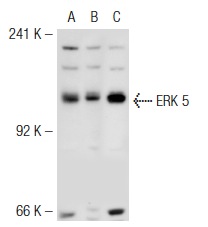 ERK 5 (C-20)-R: sc-1284-R. Western blot analysis of ERK 5 expression in non-transfected 293T: sc-117752 (A), human ERK 5 transfected 293T: sc-158487 (B) and HeLa (C) whole cell lysates.