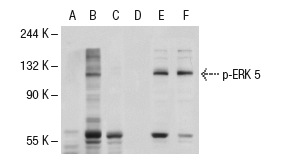 Western blot analysis of ERK 5 phosphorylation in untreated (A,D), EGF treated (B,E) and EGF and lambda protein phosphatase treated (C,F) HeLa whole cell lysates. Antibodies tested include p-ERK 5 (1.T218/Y220): sc-135760 (A,B,C) and ERK 5 (C-20)-R: sc-1284-R (D,E,F).