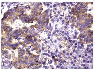ERK 5 (C-20): sc-1284. Immunoperoxidase staining of formalin fixed, paraffin-embedded human pancreas tissue showing cytoplasmic staining of islet of langerhans cells.