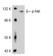 p-FAK (Ser 722): sc-16662. Western blot analysis of FAK phosphorylation in 293T whole cell lysate.