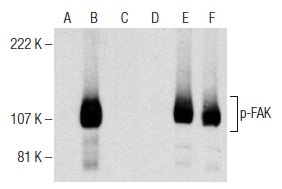 Western blot analysis of FAK phosphorylation in non-transfected: sc-117752 (A,D), untreated human FAK transfected: sc-114600 (B,E) and lambda protein phosphatase (sc-200312A) treated human FAK transfected: sc-114600 (C,F) 293T whole cell lysates. Antibodies tested include p-FAK (Ser 722)-R: sc-16662-R (A,B,C) and FAK (C-903): sc-932 (D,E,F).
