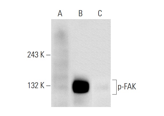 p-FAK (Tyr 861)-R: sc-16663-R. Western blot analysis of FAK phosphorylation in non-transfected: sc-117752 (A), untreated human FAK transfected: sc-114600 (B) and lambda protein phosphatase treated human FAK transfected: sc-114600 (C) 293T whole cell lysates.