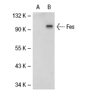 Fes (H-65): sc-25415. Western blot analysis of Fes expression in non-transfected: sc-117752 (A) and human Fes transfected: sc-114396 (B) 293T whole cell lysates.