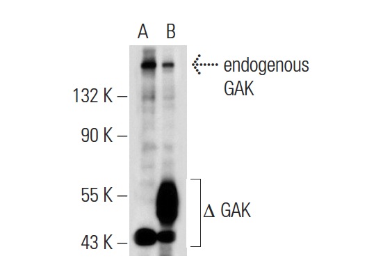 GAK (D-2): sc-137053. Western blot analysis of GAK expression in non-transfected: sc-117752 (A) and truncated human GAK transfected: sc-111171 (B) 293T whole cell lysates.