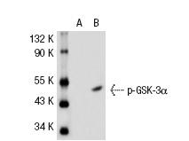 p-GSK-3α/β (Tyr 279/Tyr 216): sc-11758. Western blot analysis of GSK-3α expression in non-transfected: sc-117752 (A) and human GSK-3α transfected: sc-114699 (B) 293T whole cell lysates.
