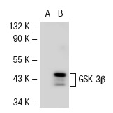 p-GSK-3α/β (Tyr 279/Tyr 216): sc-11758. Western blot analysis of GSK-3β phosphorylation in non-transfected: sc-117752 (A) and mouse GSK-3β transfected: sc-120654 (B) 293T whole cell lysates.