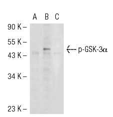 p-GSK-3α/β (Tyr 279/Tyr 216): sc-11758. Western blot analysis of GSK-3α phosphorylation in non-transfected: sc-117752 (A), untreated human GSK-3α transfected: sc-114699 (B) and lambda protein phosphatase treated human GSK-3α transfected: sc-114699 (C) 293T whole cell lysates.