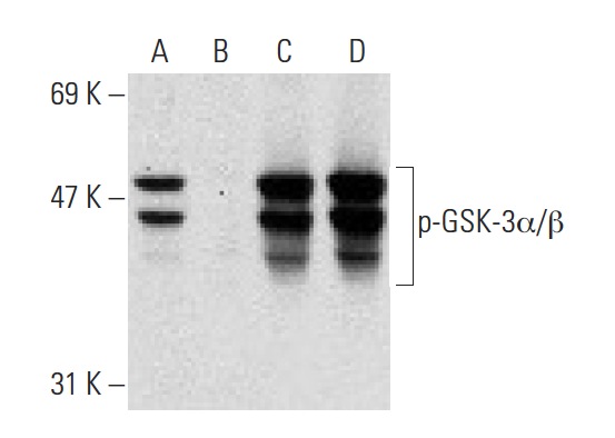 Western blot analysis of GSK-3α/β phosphorylation in untreated (A,C) and lambda protein phosphatase (sc-200312A) treated (B,D) Jurkat whole cell lysates. Antibodies tested include p-GSK-3α/β (Tyr 279/Tyr 216)-R: sc-11758-R (A,B) and GSK-3α/β (5J105): sc-71190 (C,D).