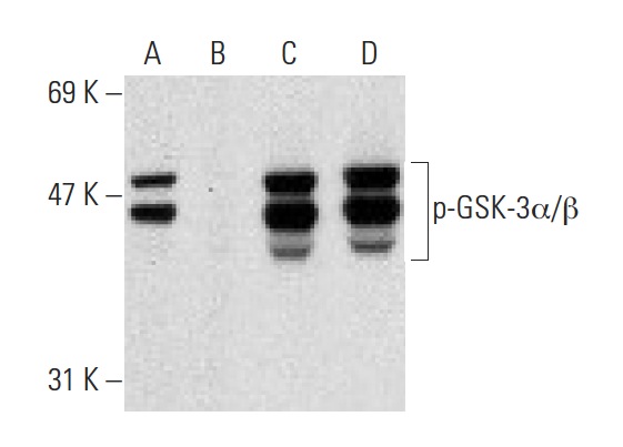 Western blot analysis of GSK-3α/β phosphorylation in untreated (A,C) and lambda protein phosphatase (sc-200312A) treated (B,D) Hs68 whole cell lysates. Antibodies tested include p-GSK-3α/β (Tyr 279/Tyr 216)-R: sc-11758-R (A,B) and GSK-3α/β (5J105): sc-71190 (C,D).