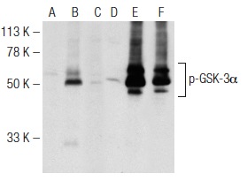 Western blot analysis of GSK-3α phosphorylation in non-transfected: sc-117752 (A,D), untreated human GSK-3α transfected: sc-114699 (B,E) and lambda protein phosphatase (sc-200312A) treated human GSK-3α transfected: sc-114699 (C,F) 293T whole cell lysates. Antibodies tested include p-GSK-3α/β (Tyr 279/Tyr 216): sc-11758 (A,B,C) and GSK-3α (H-75): sc-7879 (D,E,F).