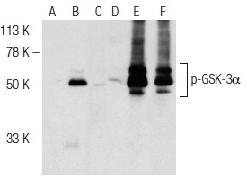 Western blot analysis of GSK-3α phosphorylation in non-transfected: sc-117752 (A,D), untreated human GSK-3α transfected: sc-114699 (B,E) and lambda protein phosphatase (sc-200312A) treated human GSK-3α transfected: sc-114699 (C,F) 293T whole cell lysates. Antibodies tested include p-GSK-3α/β (Tyr 279/Tyr 216)-R: sc-11758-R (A,B,C) and GSK-3α (H-75): sc-7879 (D,E,F).