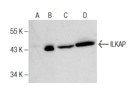 ILKAP (G-12): sc-161737. Western blot analysis of ILKAP expression in non-transfected: sc-117752 (A) and human ILKAP transfected: sc-177387 (B) 293T whole cell lysates and rat brain (C) and rat skeletal muscle (D) tissue extracts.