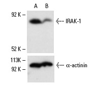IRAK-1 siRNA (h): sc-35704. Western blot analysis of IRAK-1 expression in non-transfected control (A) and IRAK-1 siRNA transfected (B) HeLa cells. Blot probed with IRAK-1 (F-4): sc-5288. α-actinin (H-2): sc-17829 used as specificity and loading control.