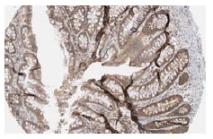 IRAK-1 (F-4): sc-5288. Immunoperoxidase staining of formalin fixed, paraffin-embedded human rectum tissue showing cytoplasmic staining of glandular cells. Kindly provided by The Swedish Human Protein Atlas (HPA) program.