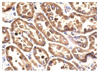 JAK2 (HR-758): sc-278. Immunoperoxidase staining of formalin fixed, paraffin-embedded human kidney tissue showing cytoplasmic staining of cells in tubules.