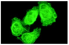 JNK (D-2): sc-7345. Immunofluorescence staining of methanol-fixed HeLa cells showing JNK localization.