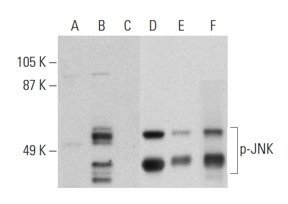 Western blot analysis of JNK phosphorylation in untreated (A,D), anisomycin treated (B,E) and anisomycin and lambda protein phosphatase (sc-200312A) treated (C,F) NIH/3T3 whole cell lysates. Antibodies tested include p-JNK (Thr 183/Tyr 185): sc-12882-R (A,B,C) and JNK (D-2): sc-7345 (D,E,F).