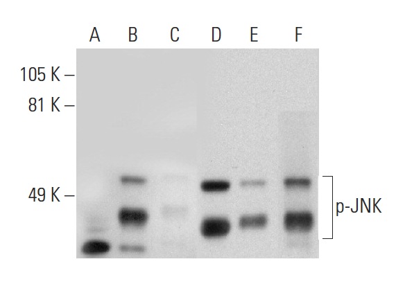 Western blot analysis of JNK phosphorylation in untreated (A,D), anisomycin treated (B,E) and anisomycin and lambda protein phosphatase (sc-200312A) treated (C,F) NIH/3T3 whole cell lysates. Antibodies tested include p-JNK (G-7): sc-6254 (A,B,C) and JNK (D-2): sc-7345 (D,E,F).