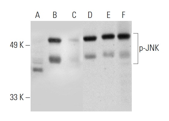 Western blot analysis of JNK phosphorylation in untreated (A,D), UV treated (B,E) and UV and lambda protein phosphatase (sc-200312A) treated (C,F) HeLa whole cell lysates. Antibodies tested include p-JNK (G-7): sc-6254 (A,B,C) and JNK (D-2): sc-7345 (D,E,F).