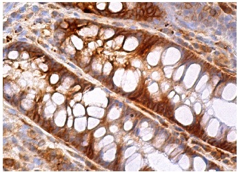 JNK1/2 (E-5): sc-137020. Immunoperoxidase staining of formalin fixed, paraffin-embedded human rectum tissue showing cytoplasmic staining of glandular cells.
