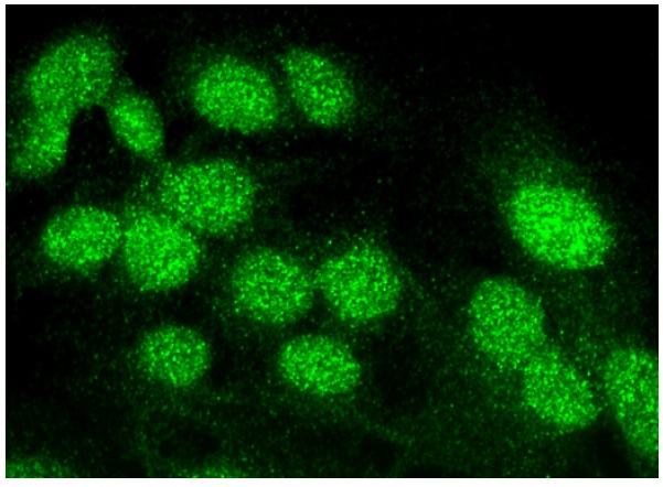 JNK1/2 (E-5): sc-137020. Immunofluorescence staining of formalin-fixed HepG2 cells showing nuclear localization.