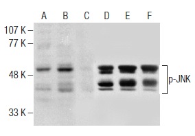 Western blot analysis of JNK phosphorylation in untreated (A,D), anisomycin treated (B,E) and anisomycin and lambda protein phosphatase (sc-200312A) treated (C,F) Jurkat whole cell lysates. Antibodies tested include p-JNK (Thr 183/Tyr 185)-R: sc-12882-R (A,B,C) and JNK (FL): sc-571 (D,E,F).