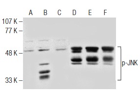 Western blot analysis of JNK phosphorylation in untreated (A,D), anisomycin treated (B,E) and anisomycin and lambda protein phosphatase (sc-200312A) treated (C,F) Jurkat whole cell lysates. Antibodies tested include p-JNK (14.Thr 183/Tyr 185): sc-293136 (A,B,C) and JNK (FL): sc-571 (D,E,F).