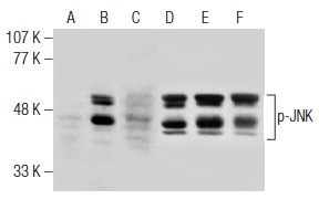 Western blot analysis of JNK phosphorylation in untreated (A,D), anisomycin treated (B,E) and anisomycin and lambda protein phosphatase (sc-200312A) treated (C,F) Jurkat whole cell lysates. Antibodies tested include p-JNK (29.Thr 183/Tyr 185): sc-293137 (A,B,C) and JNK (FL): sc-571 (D,E,F).