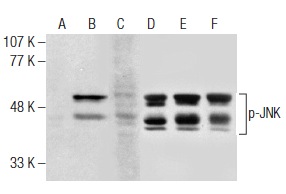 Western blot analysis of JNK phosphorylation in untreated (A,D), anisomycin treated (B,E) and anisomycin and lambda protein phosphatase (sc-200312A) treated (C,F) Jurkat whole cell lysates. Antibodies tested include p-JNK (89.Thr 183/Tyr 185): sc-293138 (A,B,C) and JNK (FL): sc-571 (D,E,F).