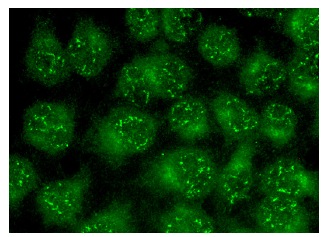 JNK2 (L-12): sc-46013. Immunofluorescence staining of methanol-fixed HeLa cells showing nuclear and cytoplasmic localization.