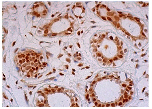 JNK1/3 (C-17)-G: sc-474-G. Immunoperoxidase staining of formalin fixed, paraffin-embedded human breast tissue showing nuclear and cytoplasmic staining of glandular cells and myoepithelial cells.