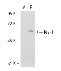 Krs-1/2 (C-19): sc-6211. Western blot analysis of Krs-1 expression in non-transfected: sc-117752 (A) and mouse Krs-1 transfected: sc-121254 (B) 293T whole cell lysates.
