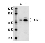 Krs-1 (N-19): sc-6212. Western blot analysis of Krs-1 expression in non-transfected: sc-110760 (A) and human Krs-1 transfected: sc-111111 (B) 293 whole cell lysates.