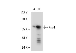 Krs-1 (N-19): sc-6212. Western blot analysis of Krs-1 expression in non-transfected: sc-110760 (A) and human Krs-1 transfected: sc-111111 (B) 293 whole cell lysates.