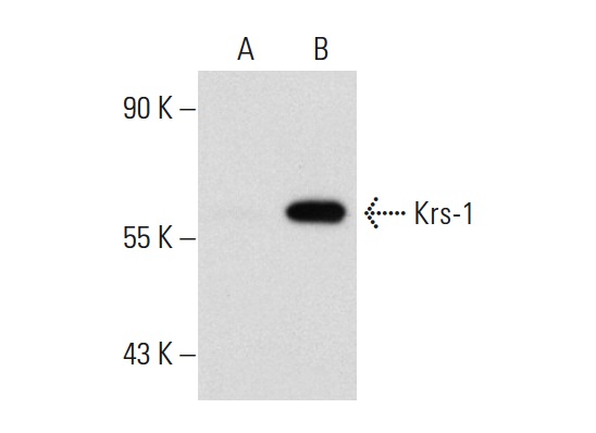 Krs-1 (N-19): sc-6212. Western blot analysis of Krs-1 expression in non-transfected: sc-110760 (A) and human Krs-1 transfected: sc-111111 (B) 293 whole cell lysates.