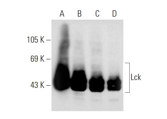 Lck (B-10): sc-166627. Western blot analysis of Lck expression in CCRF-HSB-2 (A), Jurkat (B), Molt-4 (C) and HuT 78 (D) whole cell lysates.
