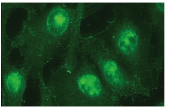 Lck (B-10): sc-166627. Immunofluorescence staining of methanol-fixed NIH/3T3 cells showing membrane localization.