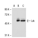 Lck (0.T.84): sc-71498. Western blot analysis of Lck expression in non-transfected 293T: sc-117752 (A), mouse Lck transfected 293T: sc-125538 (B) and HuT 78 (C) whole cell lysates.